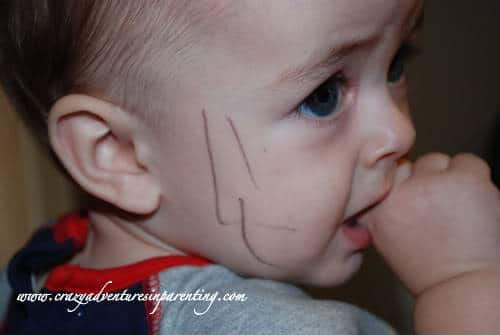 Infant pen drawing on face